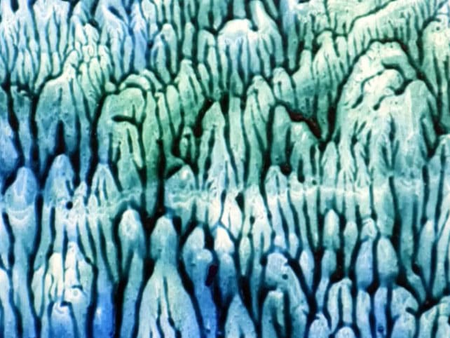 Klecks-News-Andrea-Denis